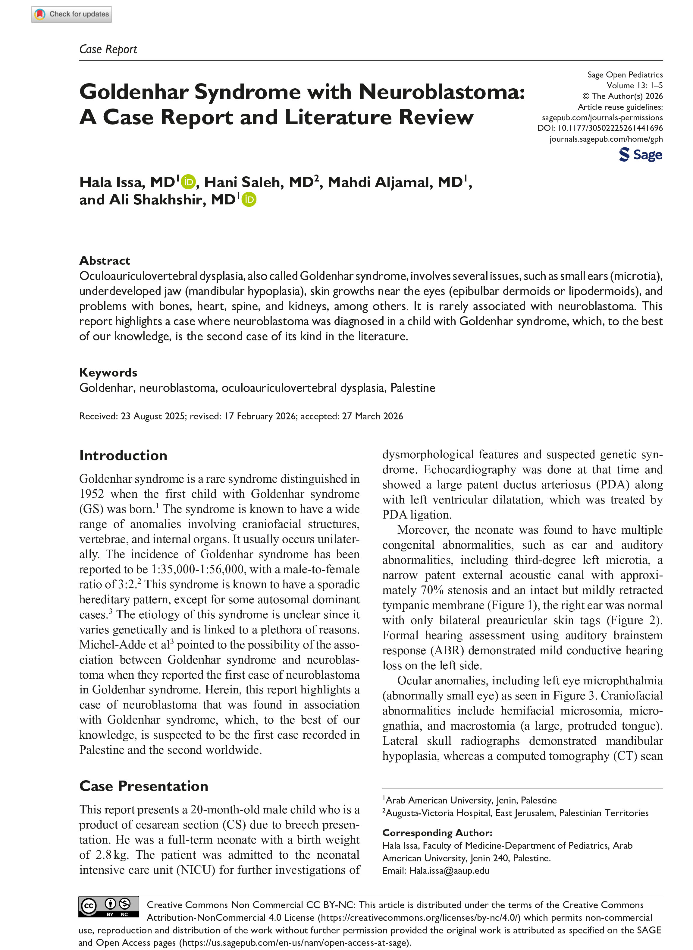 Goldenhar Syndrome with Neuroblastoma: A Case Report and Literature Review